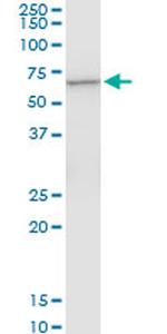 CTNS Antibody in Western Blot (WB)