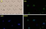 CTNNB1 Antibody in Immunocytochemistry (ICC/IF)