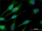 CTNNB1 Antibody in Immunocytochemistry (ICC/IF)