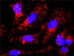 CTNNB1 Antibody in Proximity Ligation Assay (PLA) (PLA)