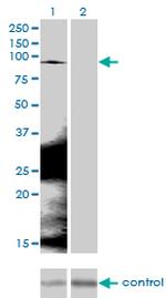 CTNNB1 Antibody in Western Blot (WB)