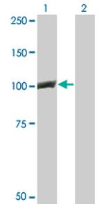 CTNNB1 Antibody in Western Blot (WB)