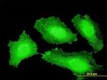 CTNNB1 Antibody in Immunocytochemistry (ICC/IF)