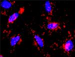 CTNNB1 Antibody in Proximity Ligation Assay (PLA) (PLA)