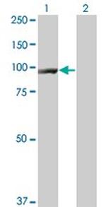 CTNNB1 Antibody in Western Blot (WB)