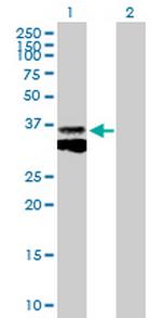 CTSB Antibody in Western Blot (WB)