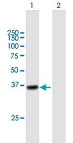 CTSL1 Antibody in Western Blot (WB)