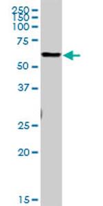 CTSL1 Antibody in Western Blot (WB)