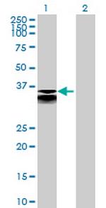 CTSL2 Antibody in Western Blot (WB)