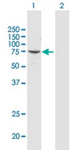 CUX1 Antibody in Western Blot (WB)