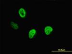 CUTL1 Antibody in Immunocytochemistry (ICC/IF)