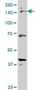 CUTL1 Antibody in Western Blot (WB)