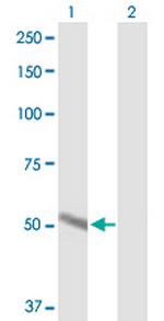 CYP2A6 Antibody in Western Blot (WB)