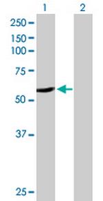 CYP2A6 Antibody in Western Blot (WB)