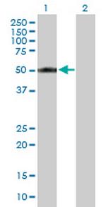 CYP2A13 Antibody in Western Blot (WB)