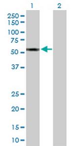 CYP2A13 Antibody in Western Blot (WB)