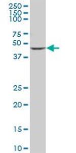 CYP2D6 Antibody in Western Blot (WB)