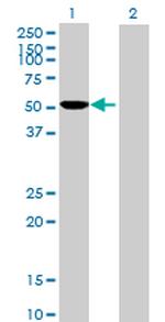 CYP2D6 Antibody in Western Blot (WB)