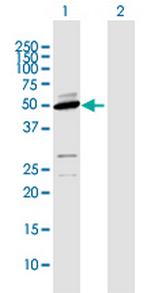 CYP2D6 Antibody in Western Blot (WB)