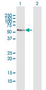 CYP2E1 Antibody in Western Blot (WB)