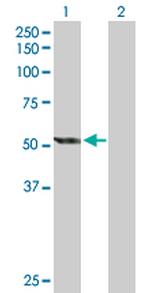 CYP2E1 Antibody in Western Blot (WB)