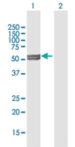 CYP11A1 Antibody in Western Blot (WB)