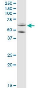 CYP11A1 Antibody in Western Blot (WB)