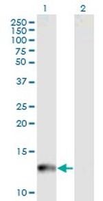 CYP24A1 Antibody in Western Blot (WB)