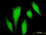 DAXX Antibody in Immunocytochemistry (ICC/IF)