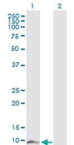 DBI Antibody in Western Blot (WB)