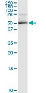 DBT Antibody in Western Blot (WB)