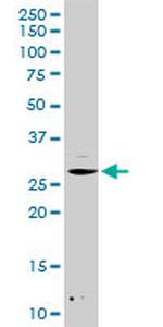 DCK Antibody in Western Blot (WB)