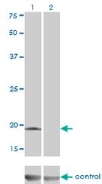 DCTD Antibody in Western Blot (WB)