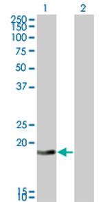 DCTD Antibody in Western Blot (WB)