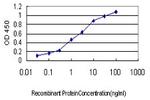 ACE Antibody in ELISA (ELISA)