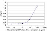 ACE Antibody in ELISA (ELISA)