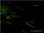 ACE Antibody in Immunocytochemistry (ICC/IF)