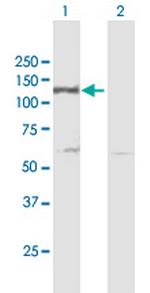 DDB1 Antibody in Western Blot (WB)