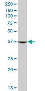 AKR1C1 Antibody in Western Blot (WB)