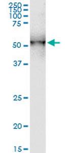 DDOST Antibody in Western Blot (WB)