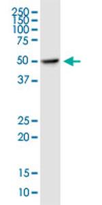 DDOST Antibody in Western Blot (WB)