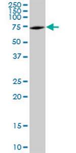 DDX5 Antibody in Western Blot (WB)