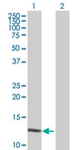 DEFA6 Antibody in Western Blot (WB)