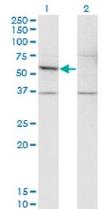 DFNA5 Antibody in Western Blot (WB)