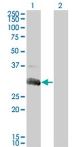 DGUOK Antibody in Western Blot (WB)