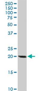 DHFR Antibody in Western Blot (WB)