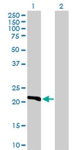 DHFR Antibody in Western Blot (WB)