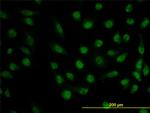 DHFR Antibody in Immunocytochemistry (ICC/IF)