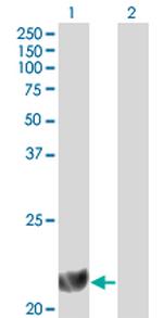 DHFR Antibody in Western Blot (WB)