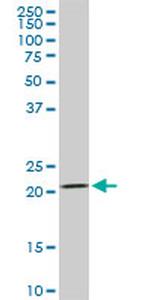 DHFR Antibody in Western Blot (WB)